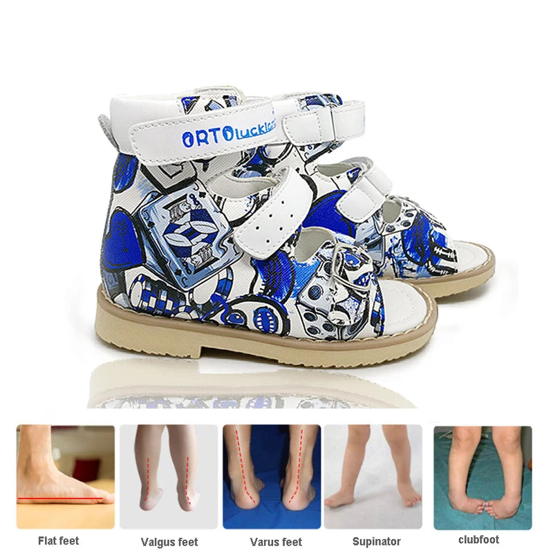 Ortoluckland Children Sandals Summer Orthopedic Buckle Strap Shoes Boys Printed Arch Support Flatfoot Footwear Size20 To32