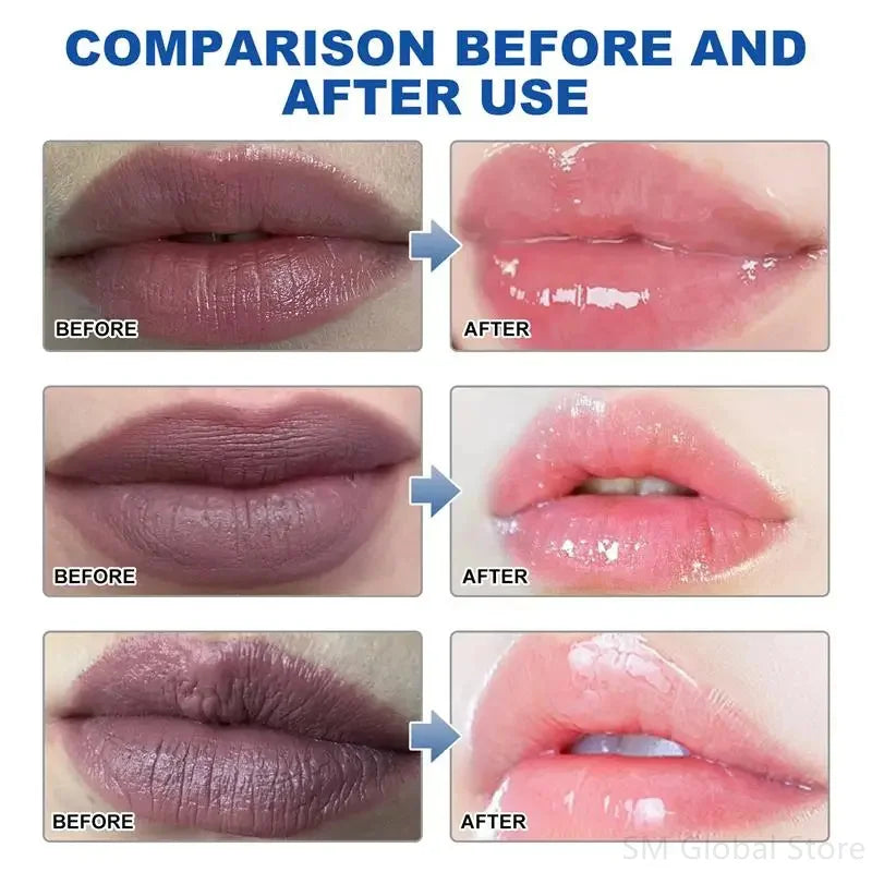 Remove Dark Lip Balm Lighten Melanin Lip Mask Exfoliating Fade Lip Line Dead Skin Moisturizing Brighten Repair Lip Care Products
