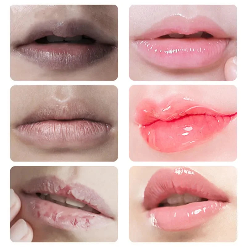 Lip Balm For Remove Dark Lip Melanin Dead Skin Removal Lighten Lip Lines Exfoliate Whitening Moisturizing Nourishing Serum 5g